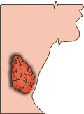 Lokalizacja tarczycy